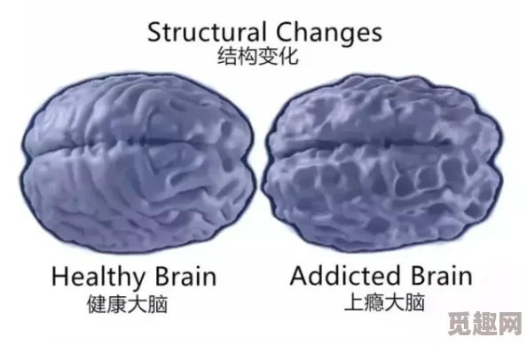 色爱综合网欧美最新研究表明网络成瘾与大脑结构变化有关