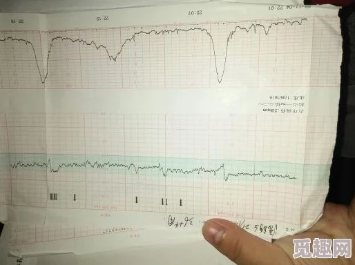 呃啊胎头嘶哑宫缩产妇已送入产房宫口开三指胎心监护正常